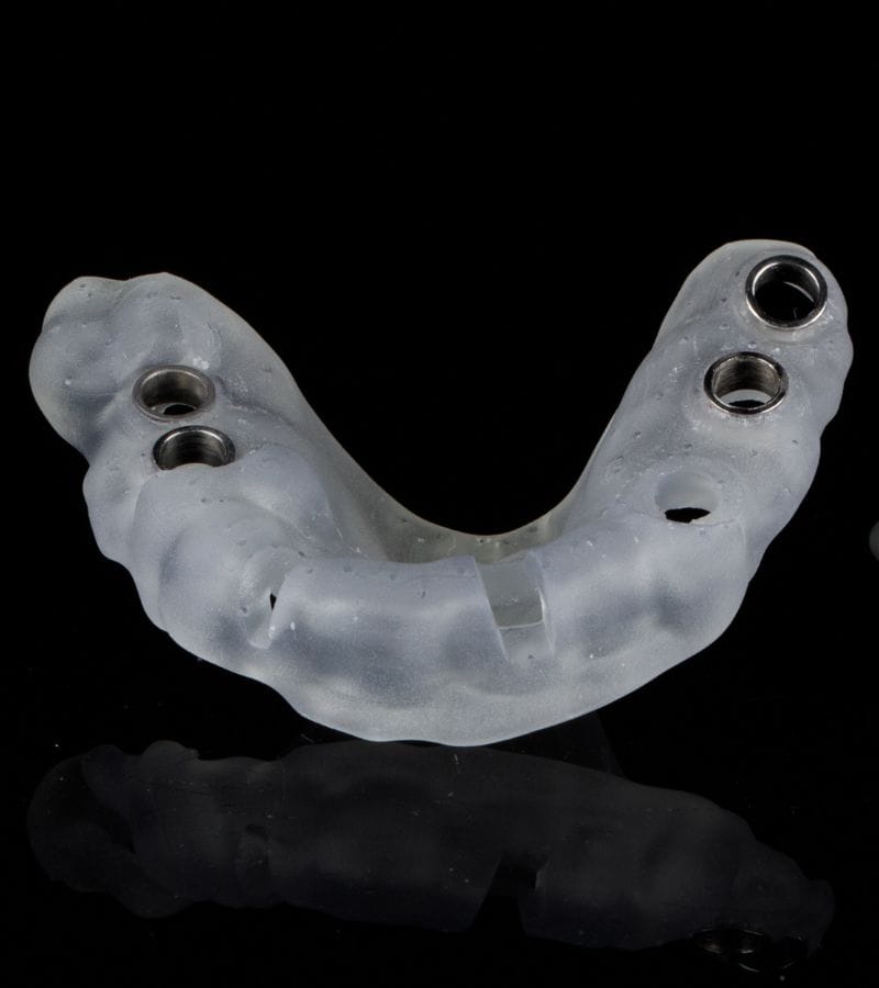 Carga inmediata en implantes Carga inmediata en implantes