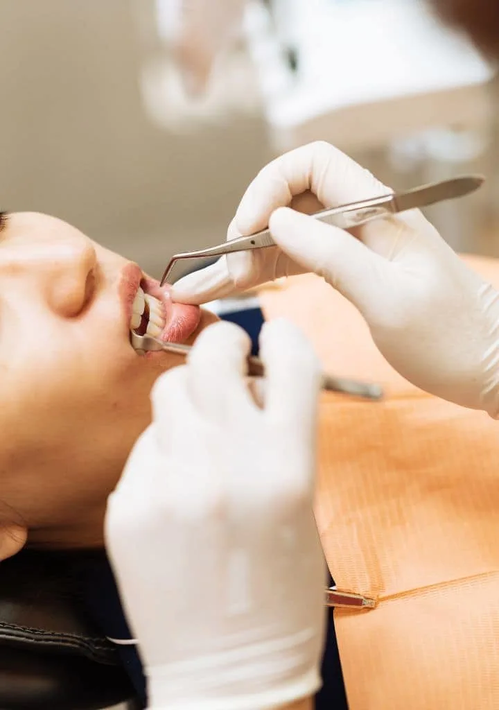 periodoncia en benidorm Periodoncia en Benidorm